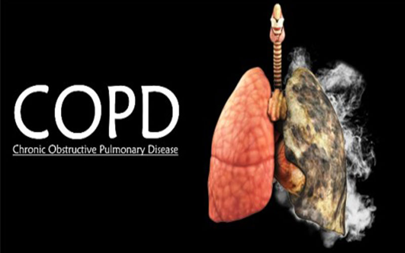 copd-benh-tat-nghen-man-tinh